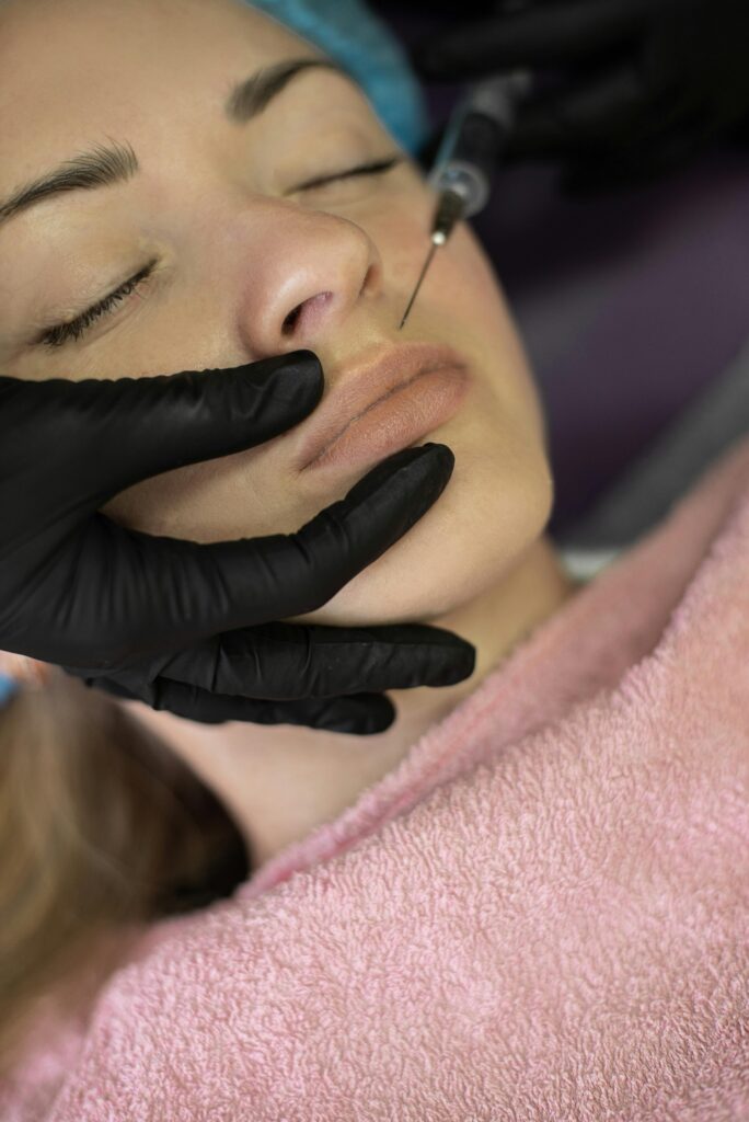 Dermal filler injection